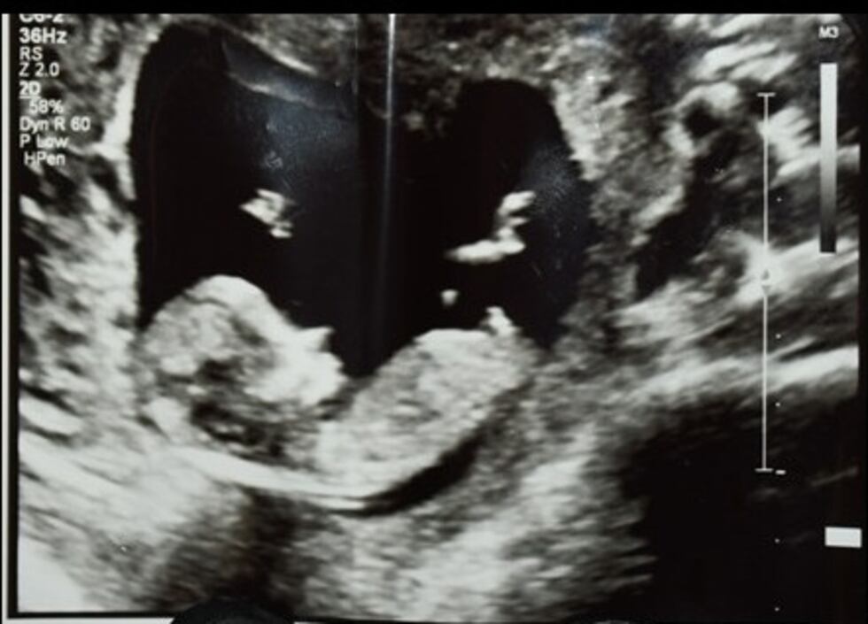 En la escena del crimen, los investigadores encontraon un casquillo y una imagen de...